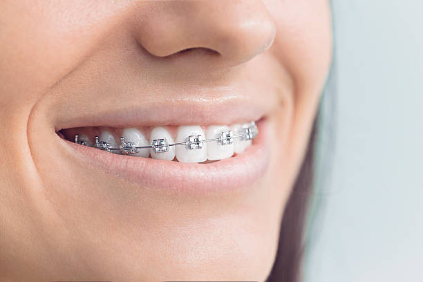 Best Veneers and Lumineers  in Mulgee, OK